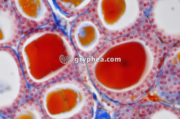 Thyroïde x160 - gryphea.com